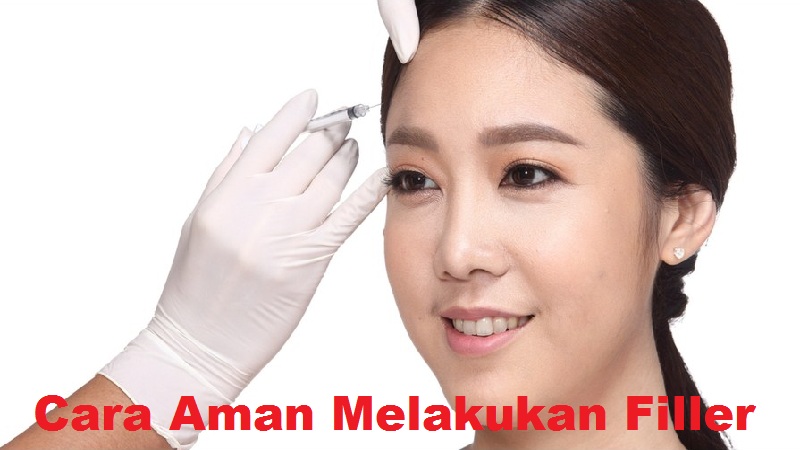 Cara Aman Melakukan Filler